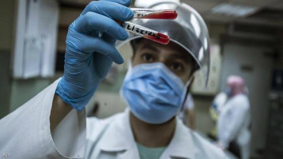 اليمن تبدأ توزيع لقاحات فيروس كورونا بالمحافظات