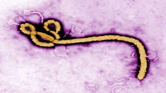 أخبار إيبولا : انتكاس ممرضة بريطانية بعد عشر شهور من شفائها