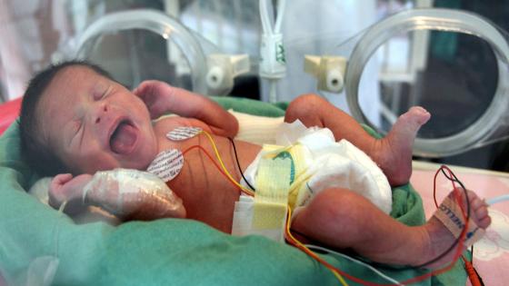 طرق الوقاية من الولادة المبكرة وأسبابها