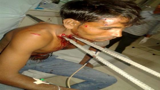 فيديو | هندي ينجوا من الموت بعد اختراق قضيبان حديد جسده
