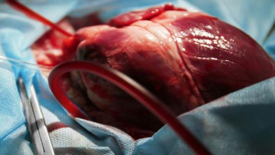 الغذاء والدواء الأمريكية تصدّق على أول صمام قلب غير جراحي